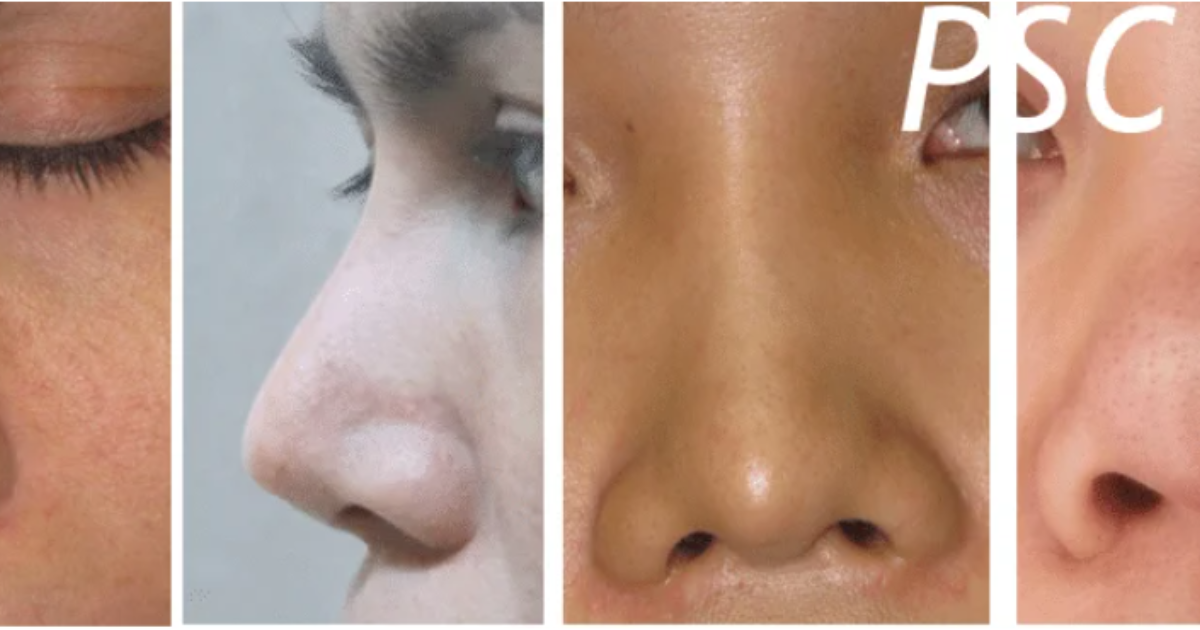 การแก้ศัลยกรรม เป็นเรื่องที่ต้องเลือกให้ดี