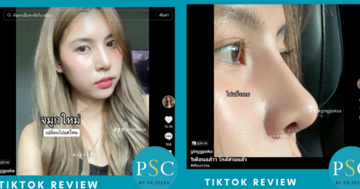 บริการยอดนิยมในการแก้ศัลยกรรมที่ PSC Clinic